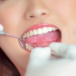 Dental implants in Manila Philippines