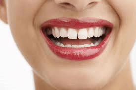 dental smile