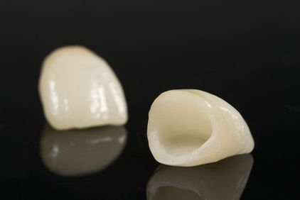full ceramic crowns