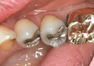 Galvanismus