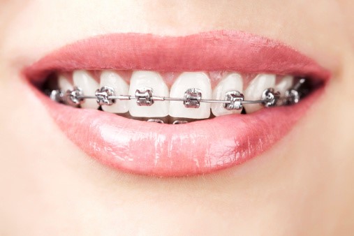 orthodontics