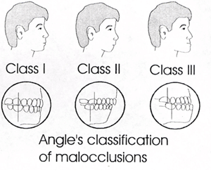classification des angles
