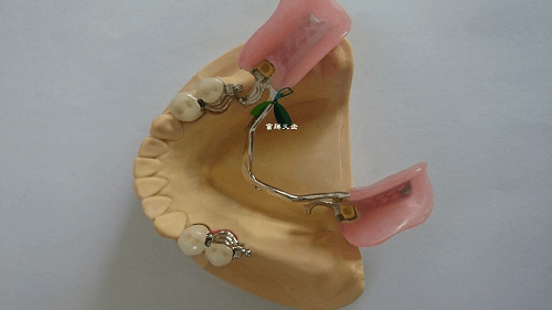 precision-denture
