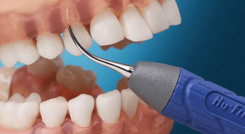 skaling subgingiva