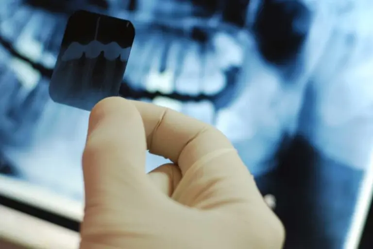Dental X-Ray Manila