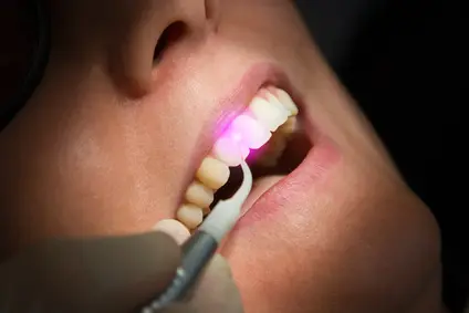 Laser in der Zahnmedizin