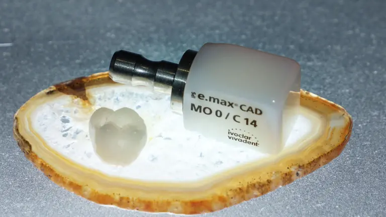 zirconia- full ceramic crowns treatment