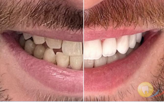 before&after
