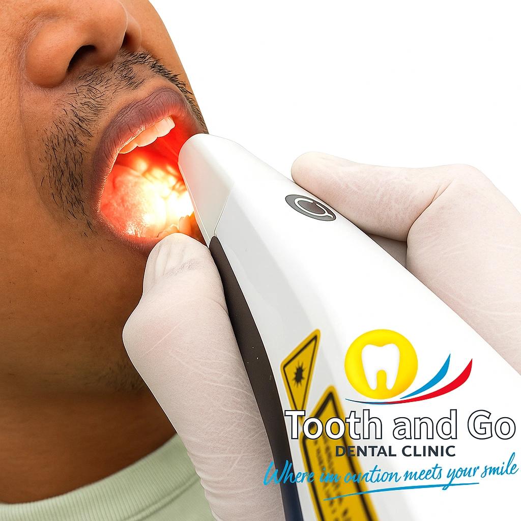pemindaian intraoral