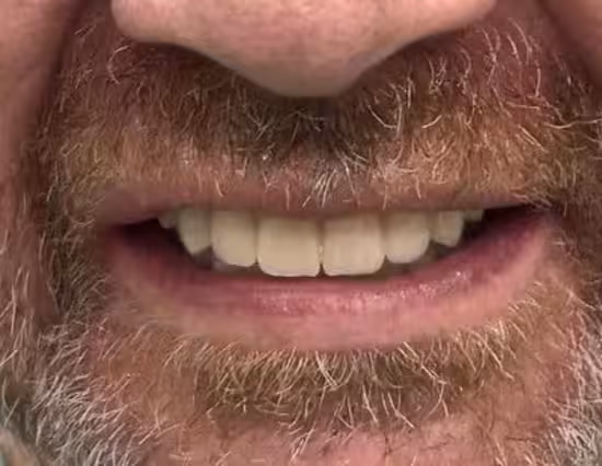 Nach