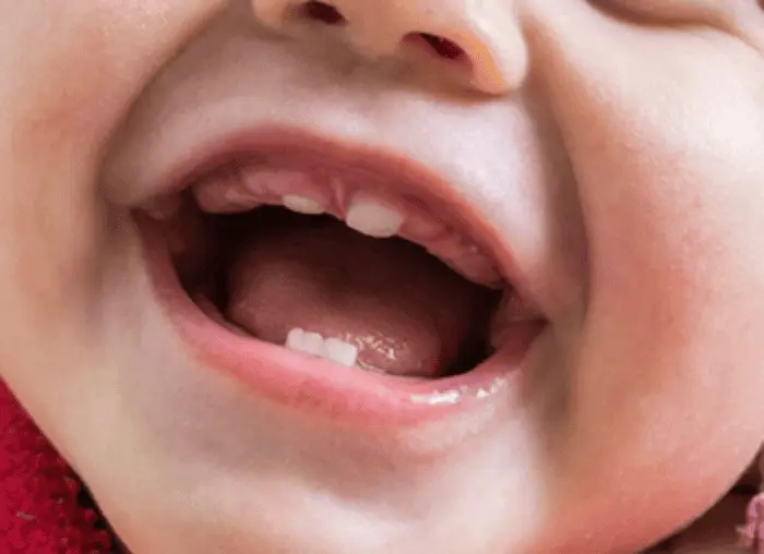 dents de lait