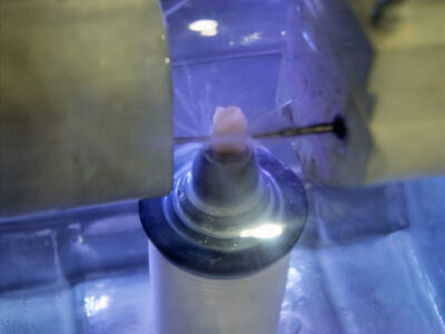 traitements endodontiques