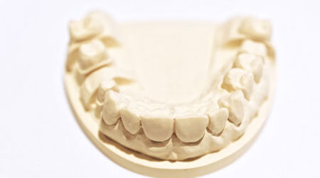 dental hard plaster